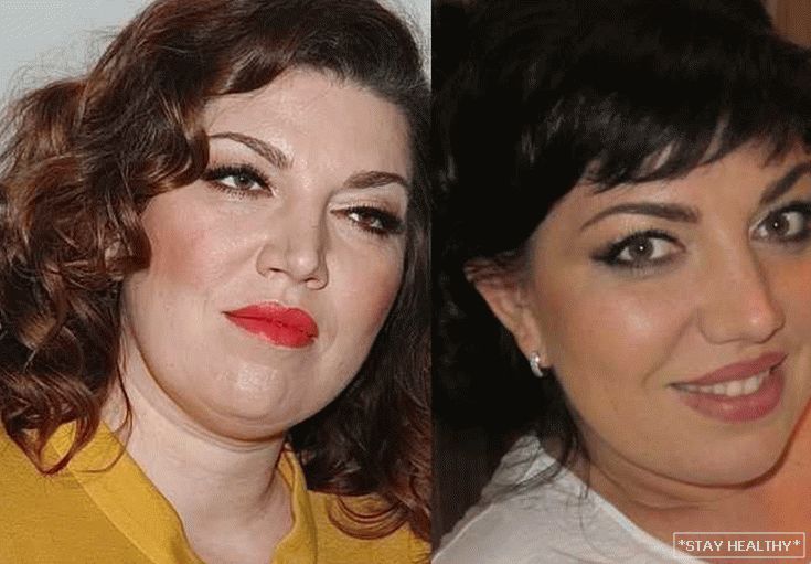 Скулкина до и после похудения