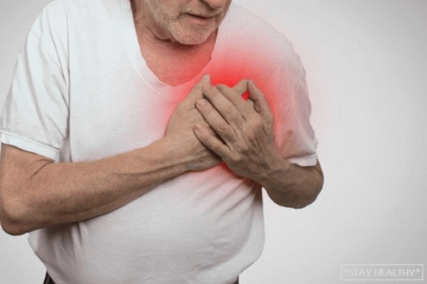 Як лікувати кардіоневроз серця